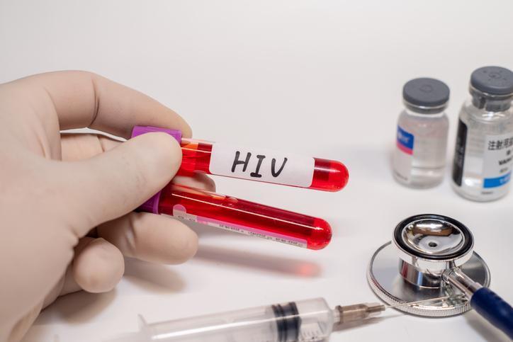 Dünya AIDS Günü Nedir?