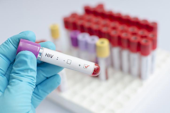 AIDS Nasıl Bulaşır?