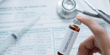 24-mart-dunya-tuberkuloz-gunu-tuberkuloz-nedir-belirtileri-nelerdir-jWuw6Wvv.jpg