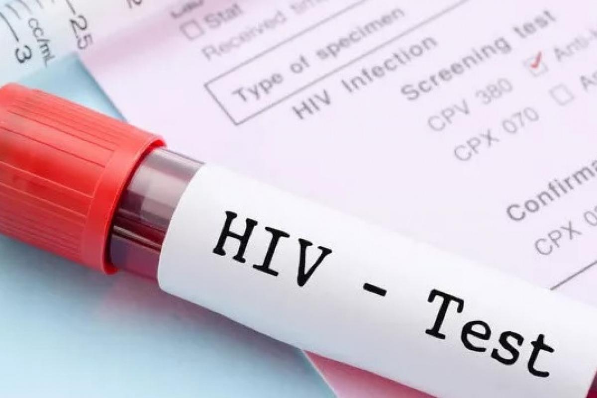 HIV/AIDS Enfeksiyonundan Korunma Yolları Nelerdir?