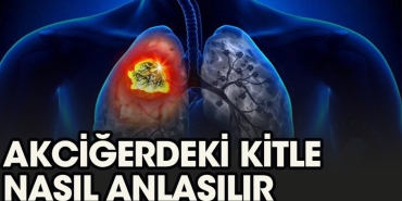 akcigerdeki-kitle-nasil-anlasilir-sMlLyfNk.jpg