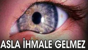 arpacik-en-kolay-nasil-guzellesir-PDSqur8e.jpg