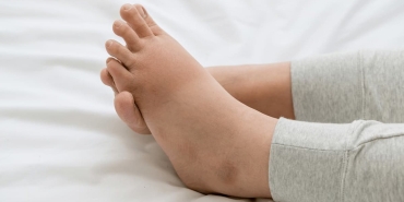 ayak-sismesi-neden-olur-nasil-gecer-Y18wdQnz.jpg