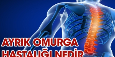 ayrik-omurga-hastaligi-nedir-wP6T2gpb.jpg