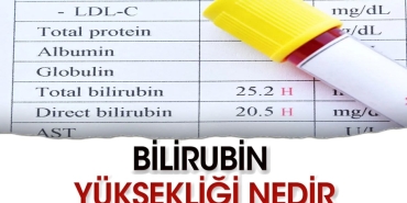 bilirubin-yuksekligi-bedelleri-nasil-duser-YJlNHSGS.jpg
