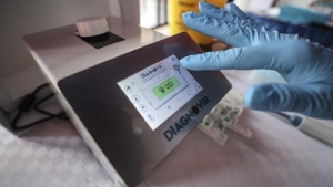 diagnovir-test-nedir-nasil-calisir-yerli-diagnovir-test-ne-kadar-guvenilir-eT6lzpUP.jpg