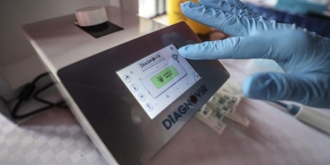 diagnovir-test-nedir-nasil-calisir-yerli-diagnovir-test-ne-kadar-guvenilir-eT6lzpUP.jpg