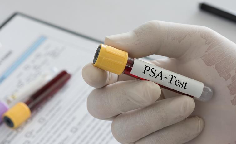 PSA Nedir, Ne Anlama Geliyor?
