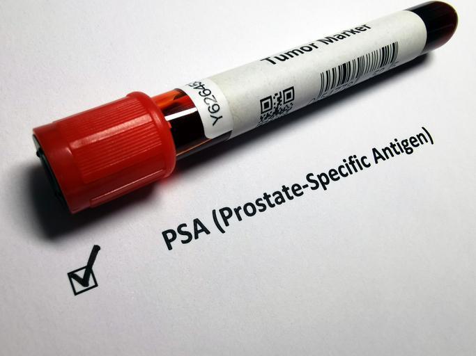 PSA (Prostat Spesifik Antijen) Nedir?