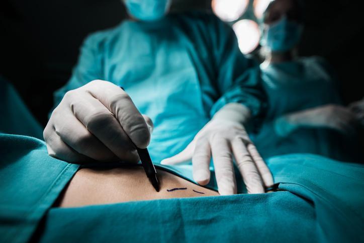 Doç. Dr. Mehtap Bozkurt'tan Lipödem Hakkında Bilgilendirme