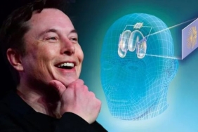 elon-muskin-cilgin-projesi-neuralink-nedir-iste-neuralink-hakkinda-bilmeniz-gereken-her-sey-JIvlUBR7.jpg