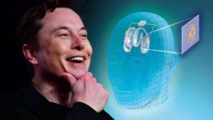 elon-muskin-cilgin-projesi-neuralink-nedir-iste-neuralink-hakkinda-bilmeniz-gereken-her-sey-JIvlUBR7.jpg