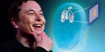 elon-muskin-cilgin-projesi-neuralink-nedir-iste-neuralink-hakkinda-bilmeniz-gereken-her-sey-JIvlUBR7.jpg