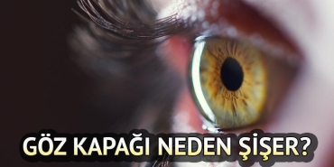 goz-kapagi-sismesi-nedenler-tedavi-yontemleri-ve-evde-uygulanabilir-cozumler-U82yJfaS.jpg