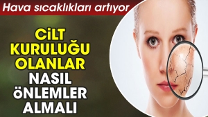 hava-sicakliklari-artiyor-cilt-kurulugu-olanlar-nasil-tedbirler-almali-7393PGNr.jpg