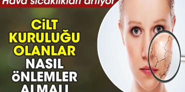 hava-sicakliklari-artiyor-cilt-kurulugu-olanlar-nasil-tedbirler-almali-7393PGNr.jpg