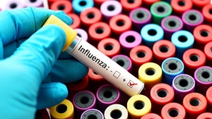 influenza-nedir-belirtileri-nelerdir-koronavirus-ve-influenza-farklari-kbSMTimb.jpg