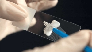 kadinlarda-en-onemli-tarama-smear-testi-nedir-e8ip69Y1.jpg