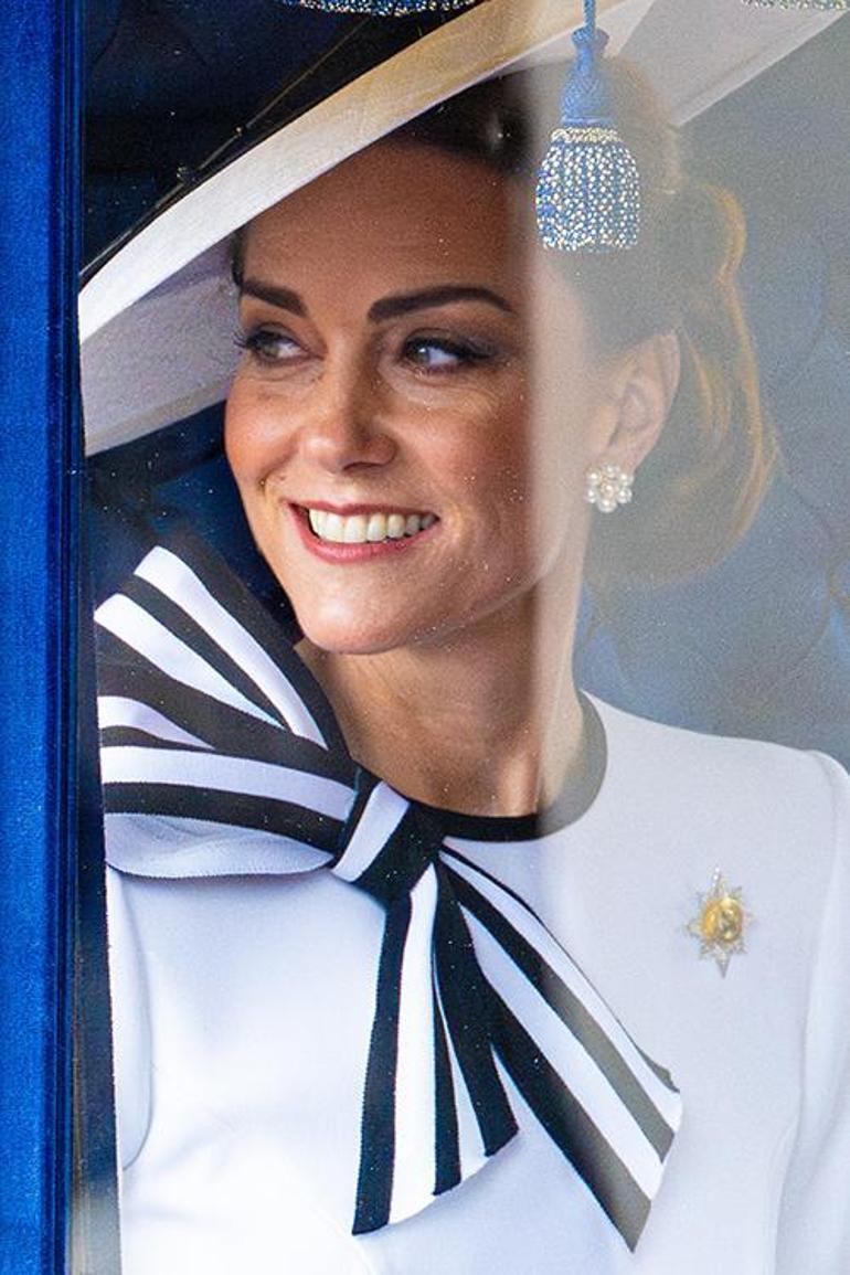 Kate Middleton'ın Zorlu Süreci