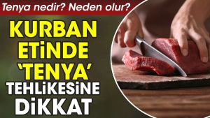 kurban-etinde-tenya-tehlikesine-dikkat-tenya-nedir-neden-olur-8JKI4AF2.jpg