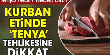 kurban-etinde-tenya-tehlikesine-dikkat-tenya-nedir-neden-olur-8JKI4AF2.jpg