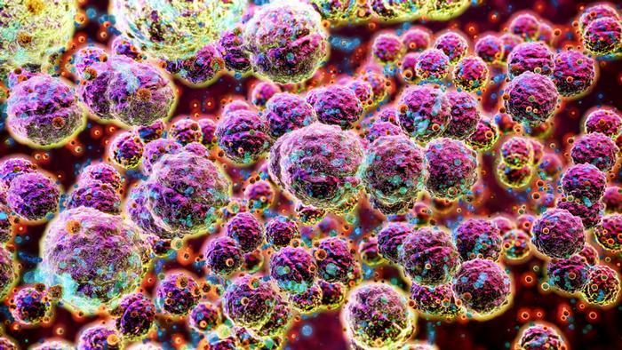 Laktoz İntoleransı: Belirtiler ve Yönetim Yöntemleri