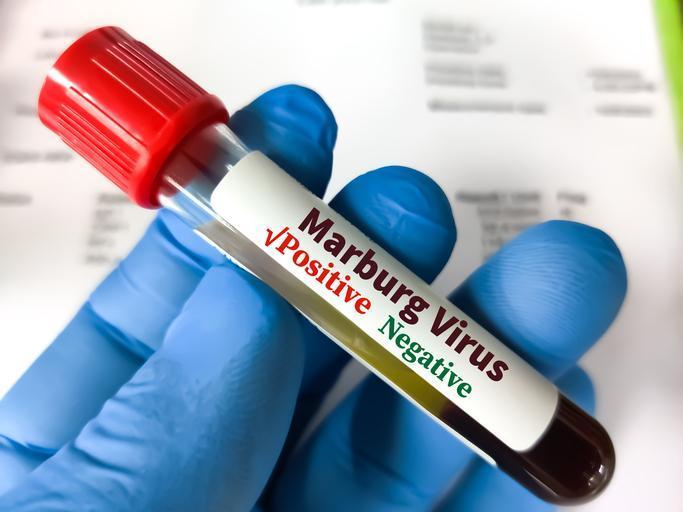 Marburg Virüsü Hakkında Bilgiler ve Son Durum