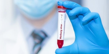marburg-virusu-hakkinda-bilgiler-ve-son-durum-PVbn1mlz.jpg