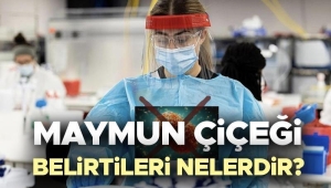 maymun-cicegi-hastaligi-belirtileri-bulasma-yontemleri-ve-tedavi-sureci-cipWKRKO.jpg