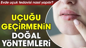 meskende-ucuk-tedavisi-nasil-yapilir-ucugu-gecirmenin-dogal-teknikleri-rmYCsBK6.jpg
