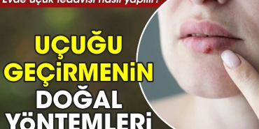 meskende-ucuk-tedavisi-nasil-yapilir-ucugu-gecirmenin-dogal-teknikleri-rmYCsBK6.jpg