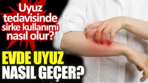 meskende-uyuz-nasil-gecer-uyuz-tedavisinde-sirke-kullanimi-nasil-olur-ye4VWJuw.jpg