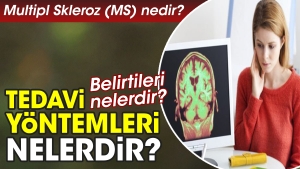 multipl-skleroz-ms-nedir-belirtileri-nelerdir-tedavi-usulleri-nelerdir-wk1nHwW7.jpg