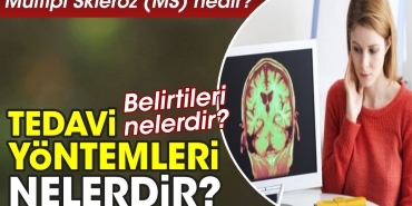 multipl-skleroz-ms-nedir-belirtileri-nelerdir-tedavi-usulleri-nelerdir-wk1nHwW7.jpg
