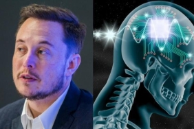 neuralink-nedir-iste-elon-muskin-yeni-cilgin-projesi-hyx7aqDM.jpg