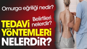 omurga-egriligi-nedir-belirtileri-nelerdir-tedavi-metotlari-nelerdir-j11WHmvG.jpg