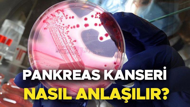 Pankreas Kanseri Hakkında Bilgiler