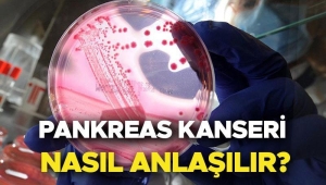 pankreas-kanseri-belirtileri-risk-faktorleri-ve-tedavi-yontemleri-Mtq9wxRK.jpg