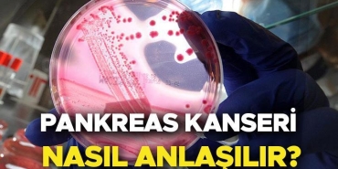 pankreas-kanseri-belirtileri-risk-faktorleri-ve-tedavi-yontemleri-Mtq9wxRK.jpg