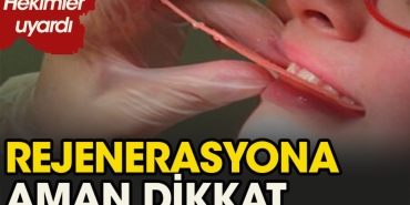 rejenerasyon-metodu-nedir-Jd8MZuOO.jpg