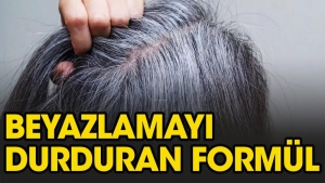 sac-beyazlamasi-nasil-durdurulur-fDQwN4He.jpg
