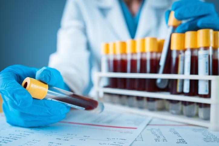 Sepsis: Yaşlılar, Hamileler ve Küçük Çocuklar İçin Tehlikeli Bir Risk