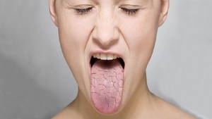 sjogren-sendromu-nedir-belirtileri-nelerdir-sjogren-sendromu-tedavisi-var-mi-rOeHm5LM.jpg