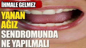 yanan-agiz-sendromunda-ne-yapilmali-nIuKK68G.jpg