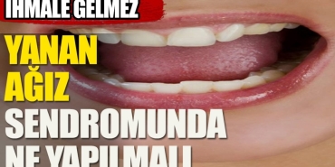 yanan-agiz-sendromunda-ne-yapilmali-nIuKK68G.jpg