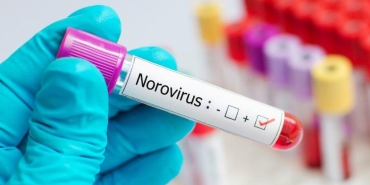 yeni-tehlike-norovirus-nedir-belirtileri-nelerdir-vakalar-3-kat-artti-KTxFrUgH.jpg