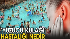 yuzucu-kulagi-hastaligi-nedir-KLpl3YF4.jpg