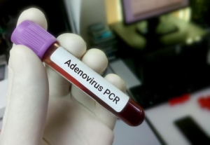 adenovirus-nedir-belirtileri-neler-nasil-bulasir-tolgahan-sayisman-uyardi-10-gundur-mucadele-veriyoruz-cocuklariniza-21M7ngQB.jpg