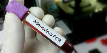 adenovirus-nedir-belirtileri-neler-nasil-bulasir-tolgahan-sayisman-uyardi-10-gundur-mucadele-veriyoruz-cocuklariniza-21M7ngQB.jpg